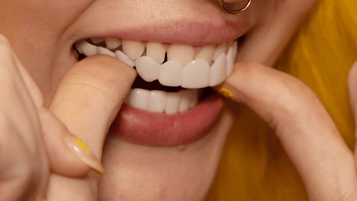 Instant Smile Veneer Set - Removable Upper and Lower Teeth Veneers