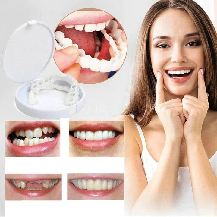 FlexiSmile Custom-Fit Snap-On Cosmetic Veneers Upper & Lower Set