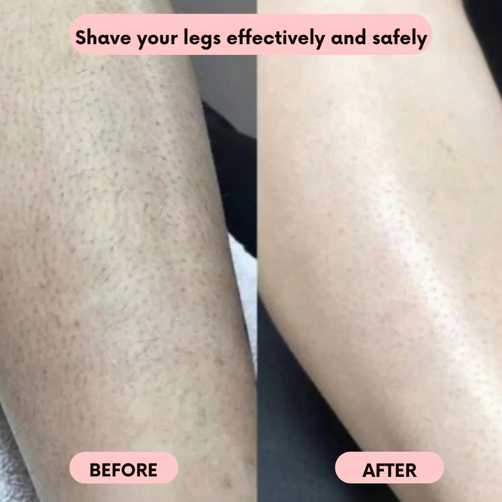 Intimate Shaver | Wireless Electric Shaver | Gentle Wet and Dry Shaving | IntimLisse