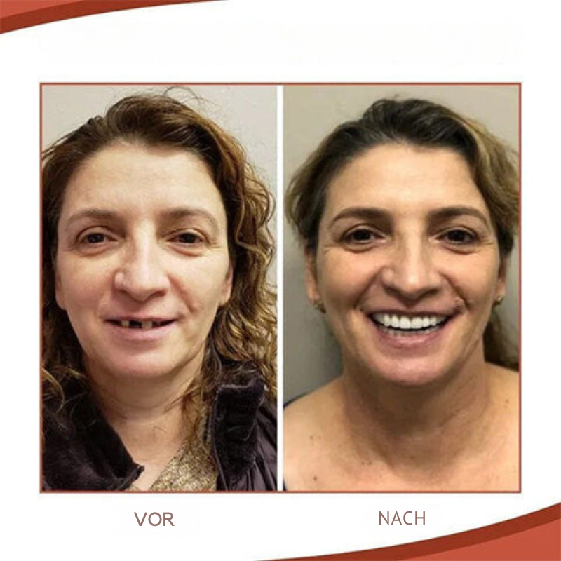Denture Adjustment Set Silicone Comfortable Fit Natural Smile 5 Age Variants for Men and Women | Sansoti