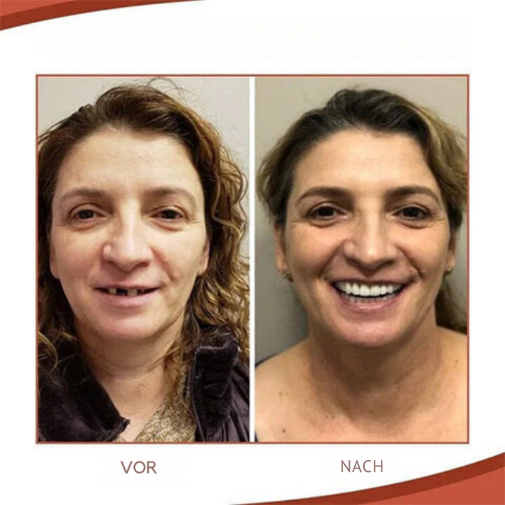 Denture Adjustment Set Silicone Comfortable Fit Natural Smile 5 Age Variants for Men and Women | Sansoti