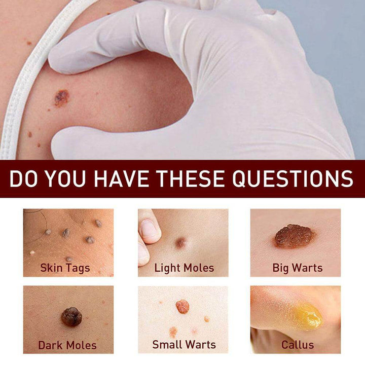 Tags and Moles Remover
